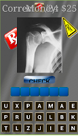 incidence radiologique game