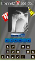 incidence radiologique game