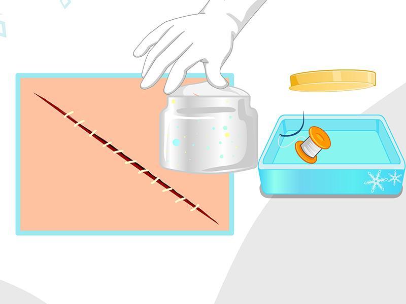 Girl appendicitis surgery game