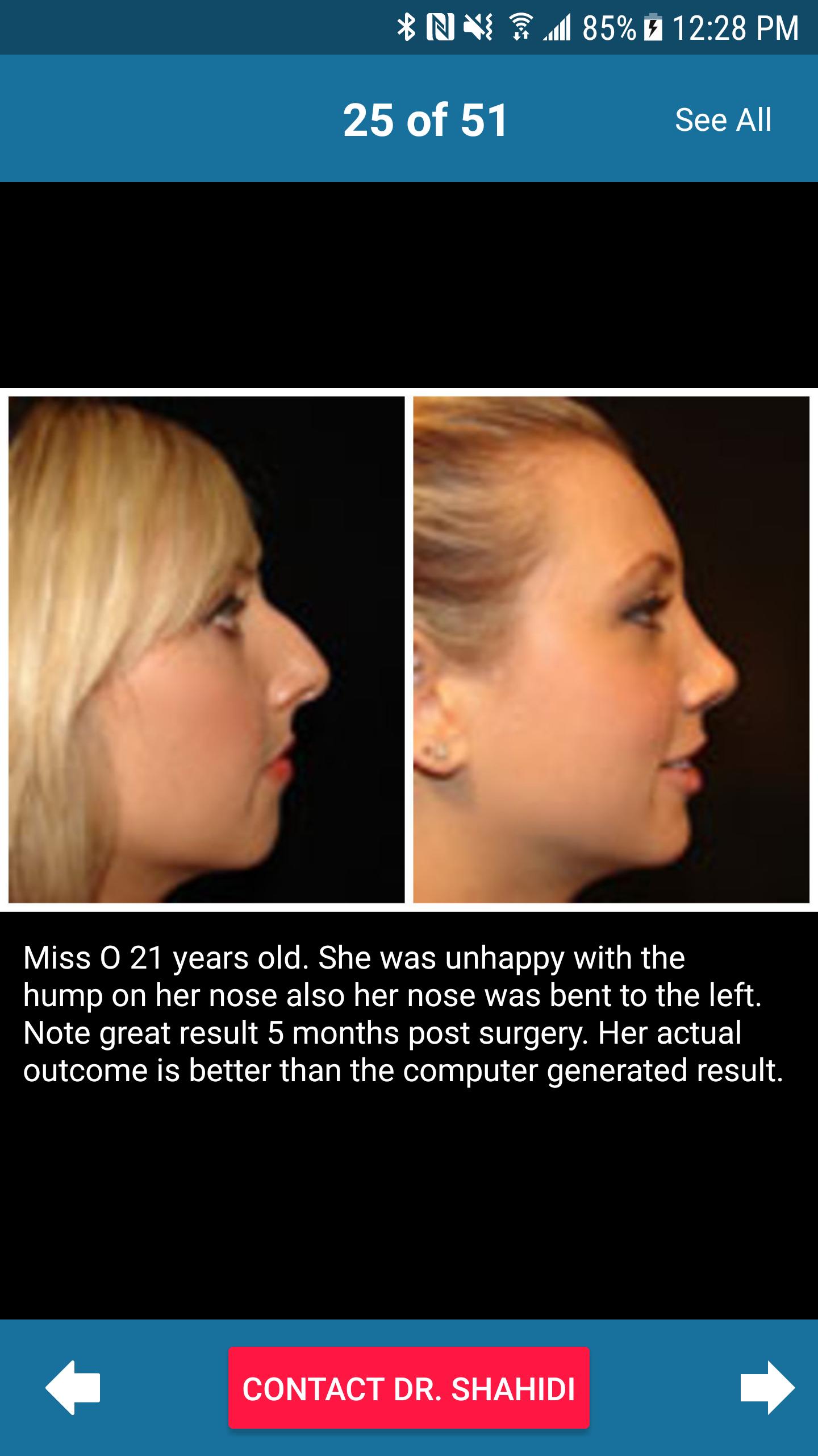 Plastic Surgery in Sydney