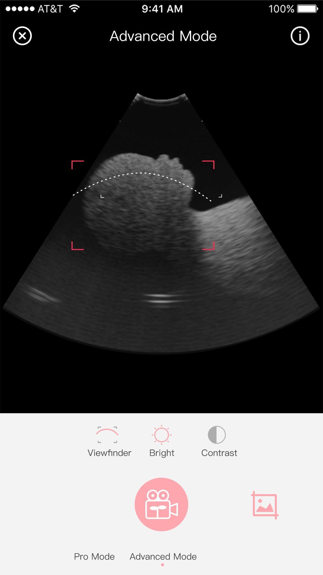 MARVOTO Fetus Camera