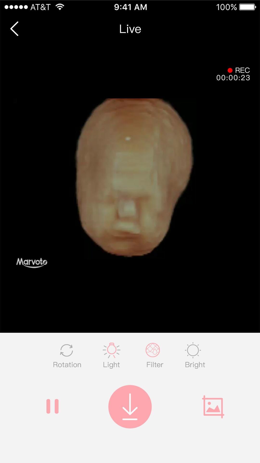 MARVOTO Fetus Camera