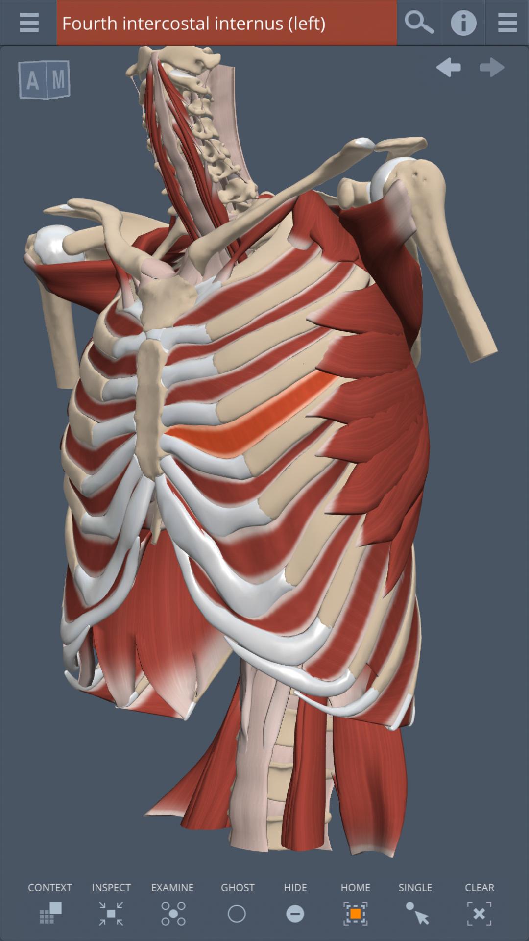 Thorax: 3D RT - Sub